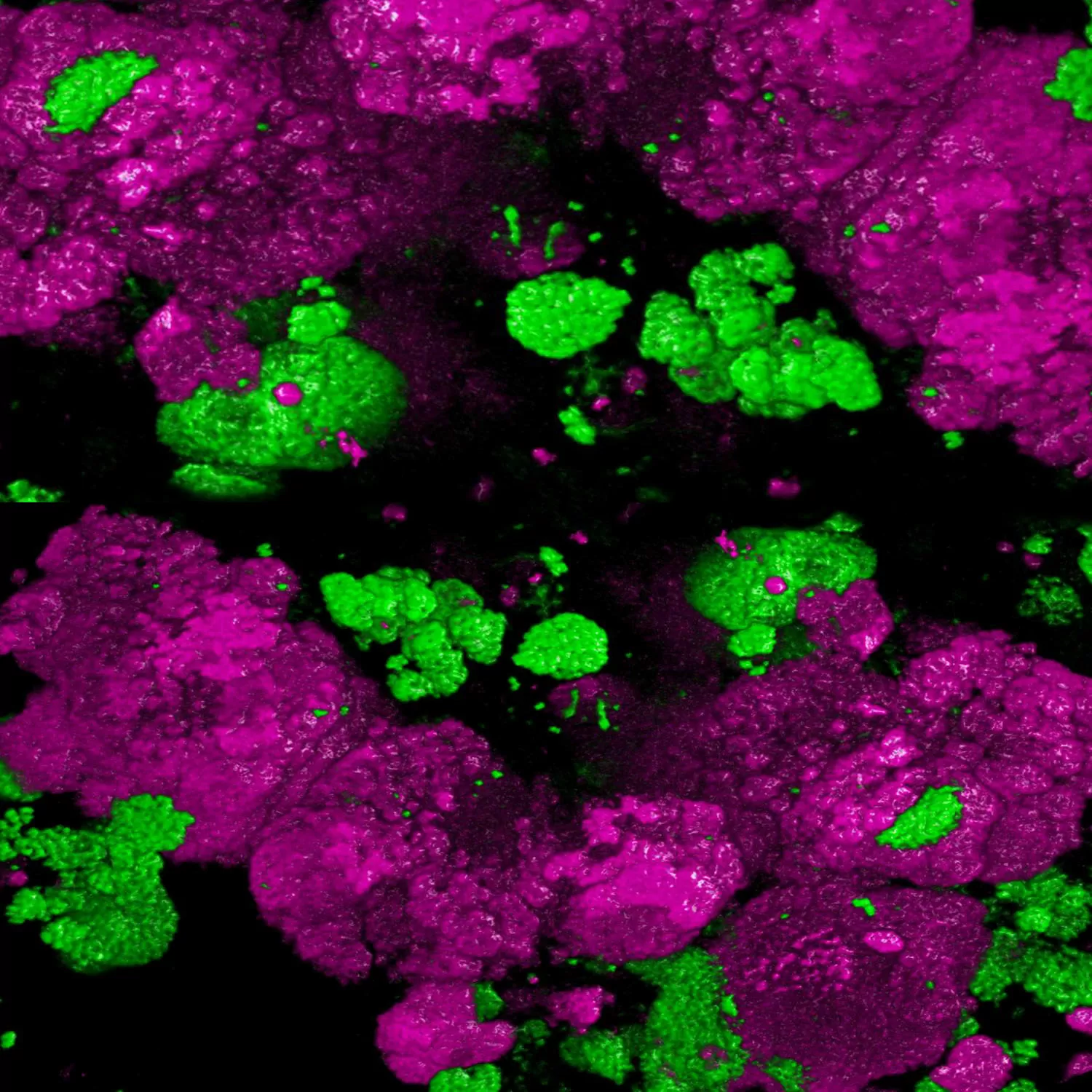 Colonia bacteriana bajo el microscopio usando técnicas de tinción de fluorescencia.